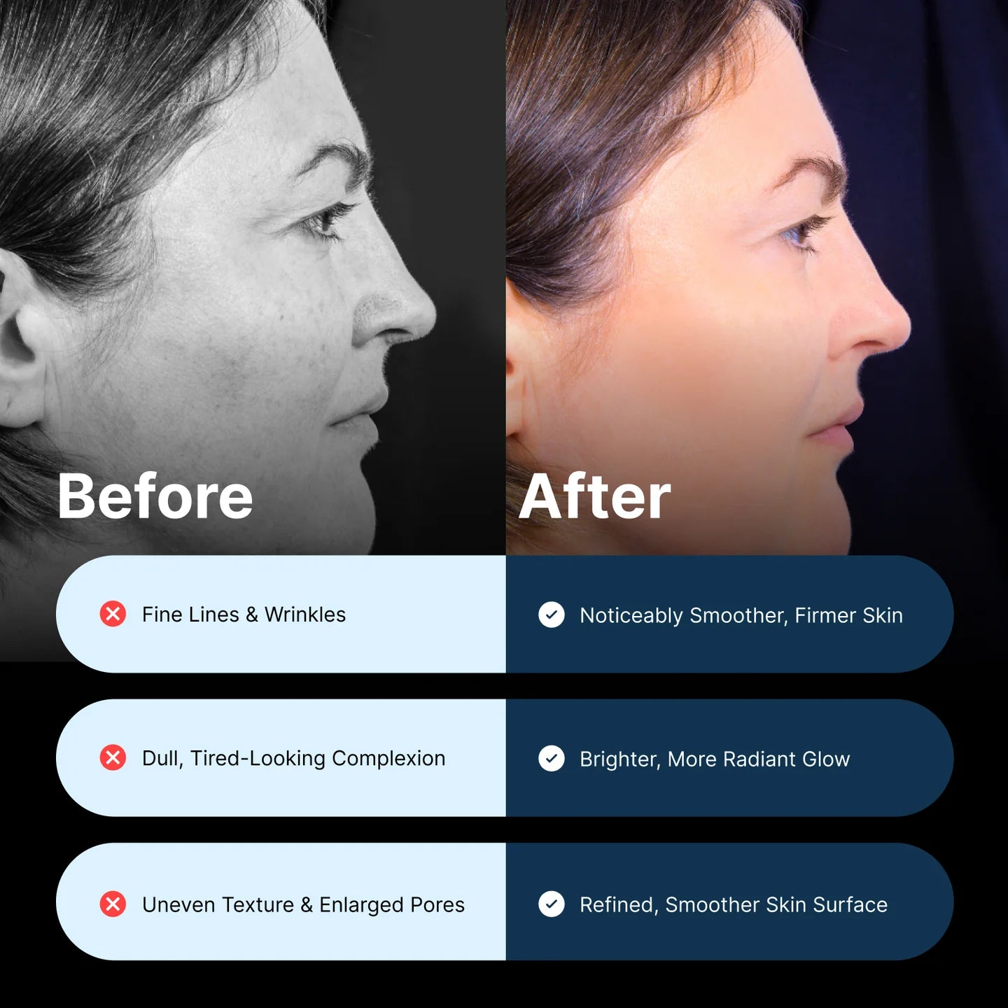 YouthRite Anti-Aging Patch